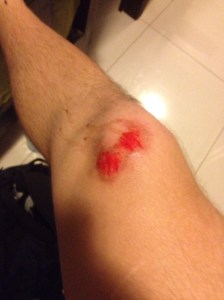 Thankfully, the gash on me knee was the only real injury I sustained during the ordeal.